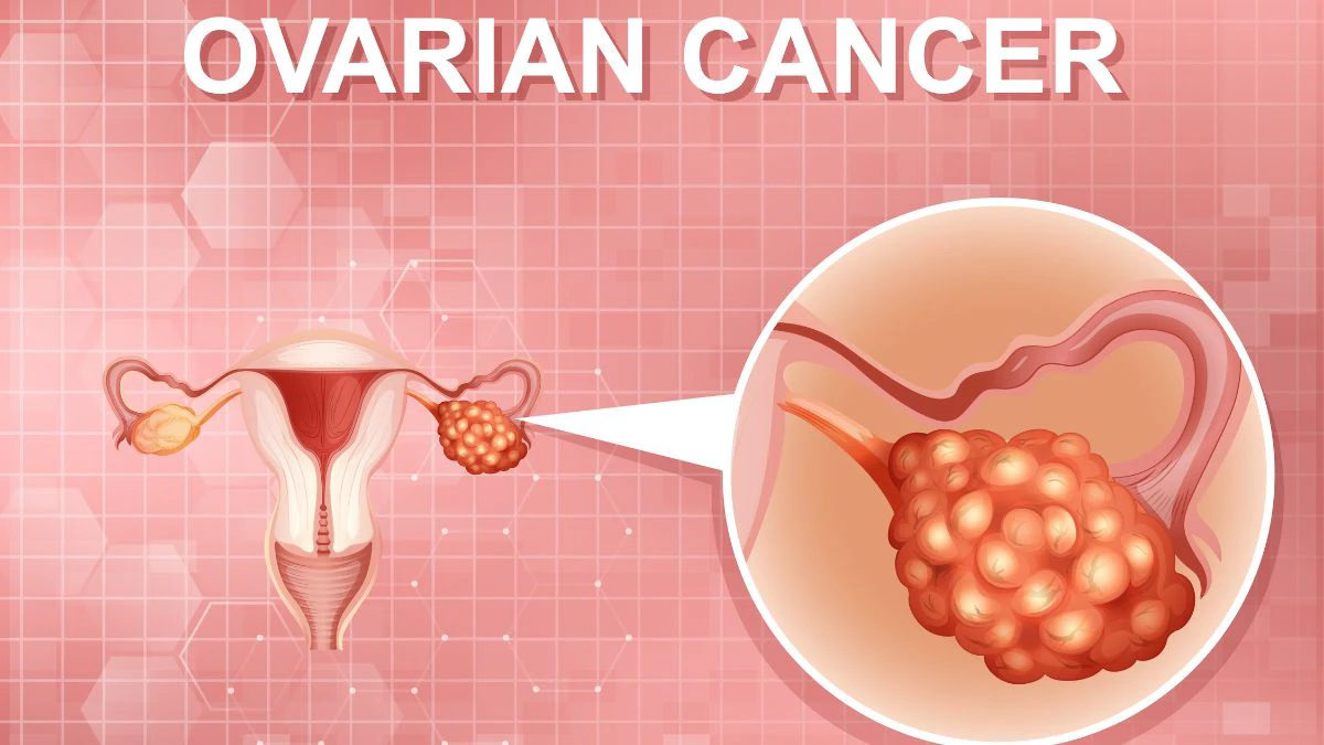 silent-threats-unveiling-the-warning-signs-of-ovarian-cancer-and